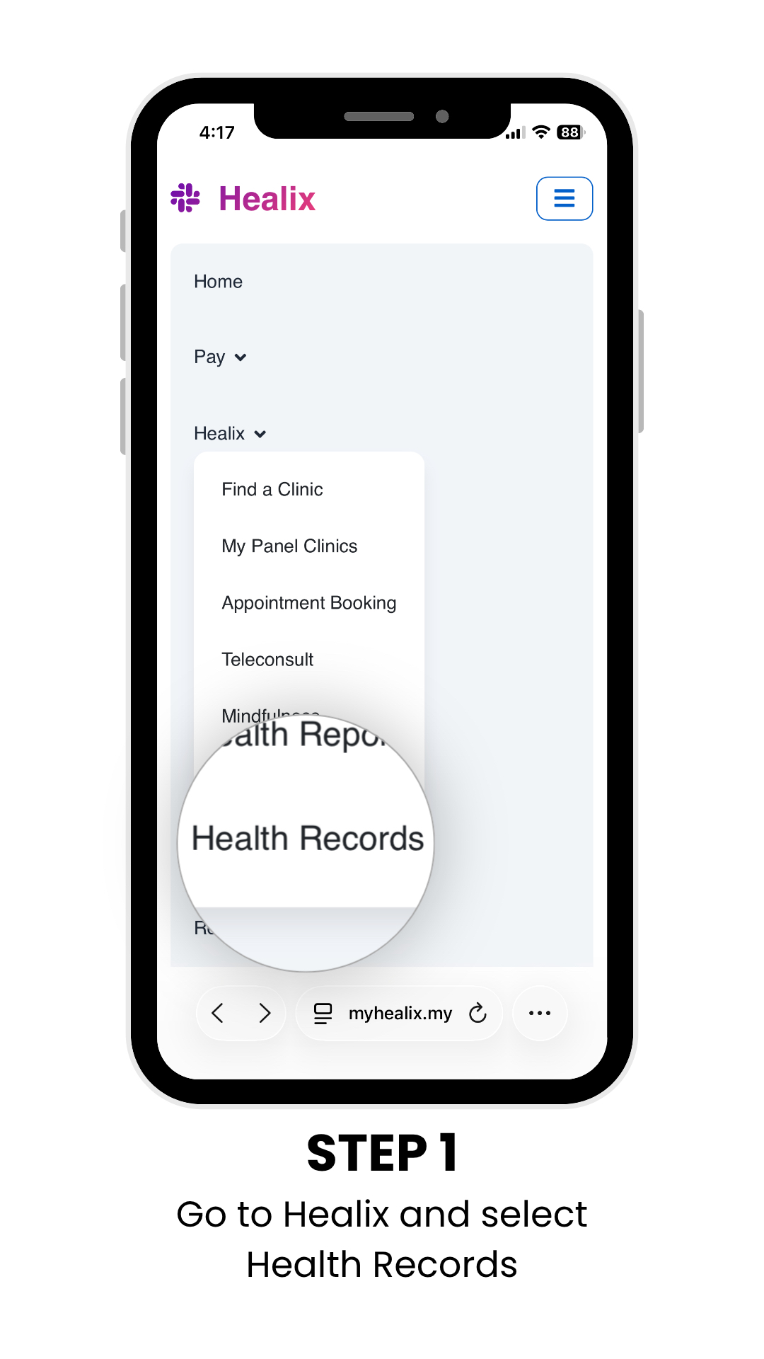 Step 1 — Get tested at the lab